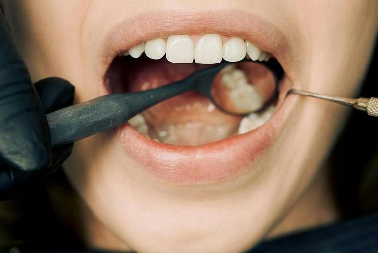 Реабилитация после установки имплантов