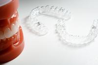 Элайнеры на модели горизонтальное фото