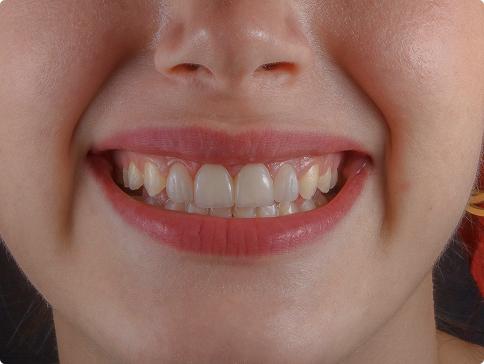 Фотогалерея 1